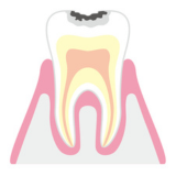 【CO】