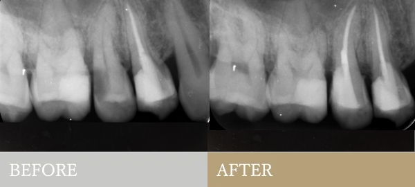 BEFORE AFTER