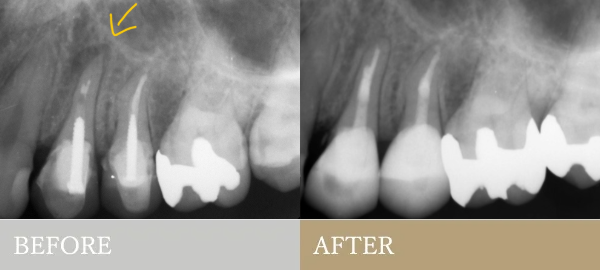 BEFORE AFTER