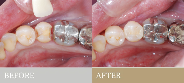 BEFORE AFTER